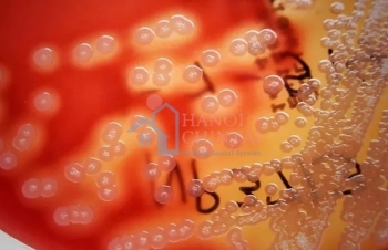 Kết hợp sợi đay tự nhiên với vi khuẩn Bacillus pumilus có thể cải thiện độ bền của bê tông